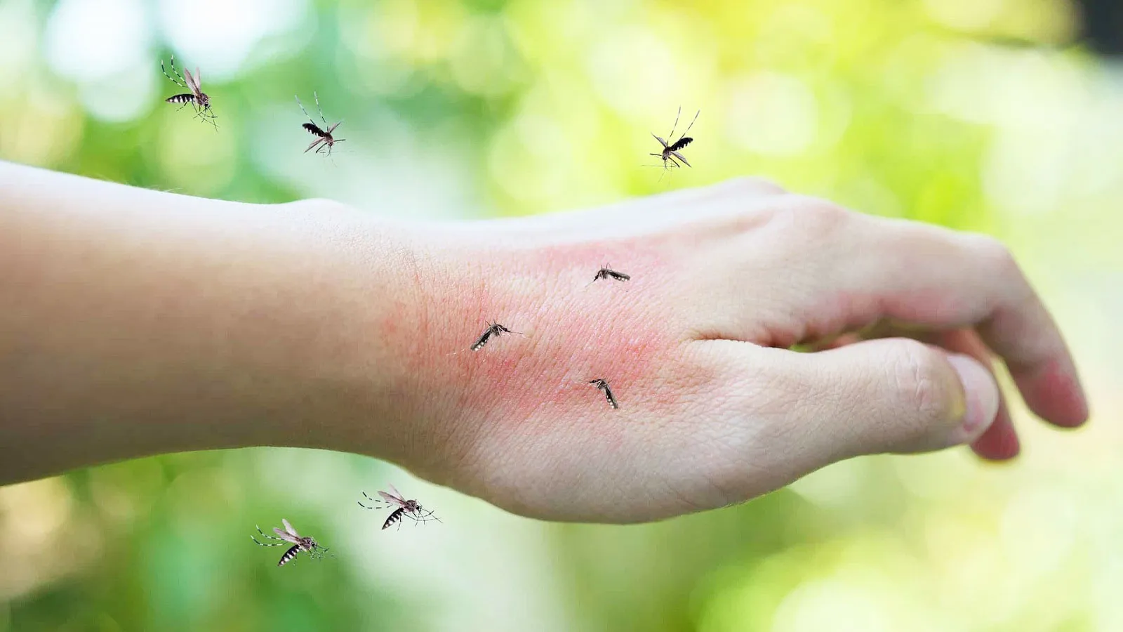 Tại sao có người thường bị muỗi đốt nhiều hơn